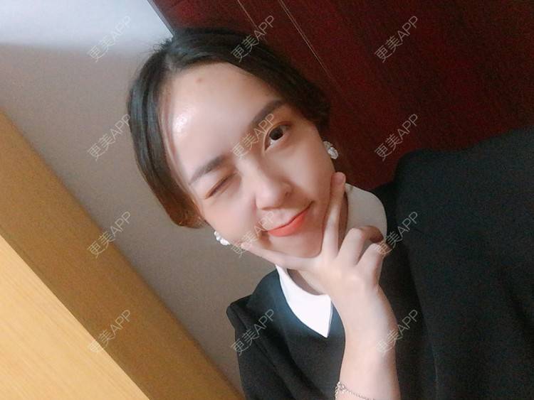 更美 - 更美用户m4XQ4UtYyh的菲欧曼经验 | 杭州 | 菲欧曼