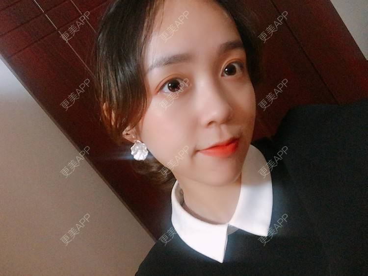 更美 - 更美用户m4XQ4UtYyh的菲欧曼经验 | 杭州 | 菲欧曼