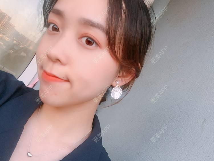 更美 - 更美用户m4XQ4UtYyh的菲欧曼经验 | 杭州 | 菲欧曼