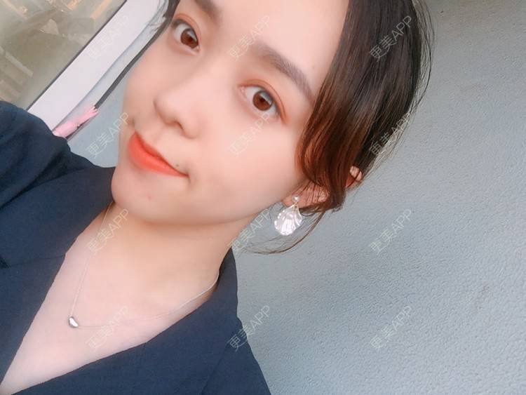 更美 - 更美用户m4XQ4UtYyh的菲欧曼经验 | 杭州 | 菲欧曼