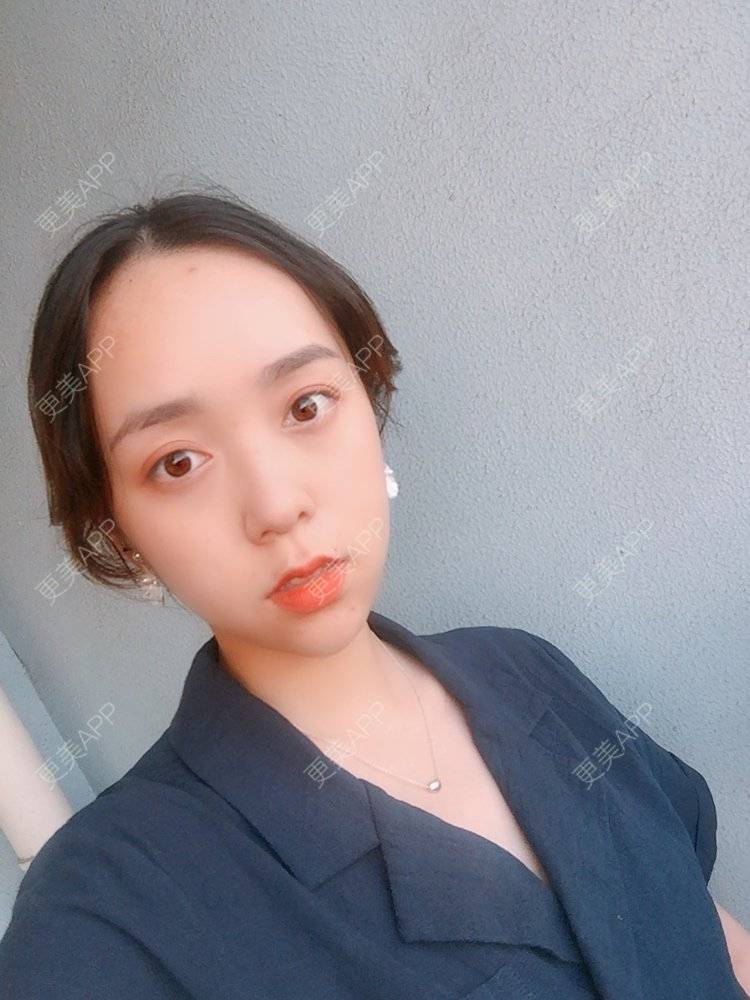 更美 - 更美用户m4XQ4UtYyh的菲欧曼经验 | 杭州 | 菲欧曼