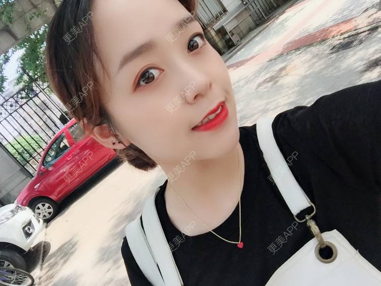 更美 - 更美用户m4XQ4UtYyh的菲欧曼经验 | 杭州 | 菲欧曼