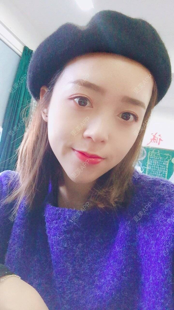 更美 - 更美用户m4XQ4UtYyh的菲欧曼经验 | 杭州 | 菲欧曼