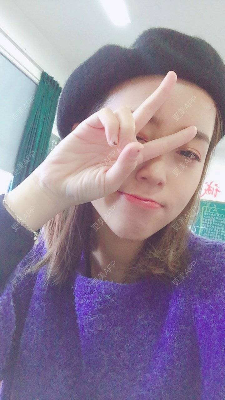 更美 - 更美用户m4XQ4UtYyh的菲欧曼经验 | 杭州 | 菲欧曼