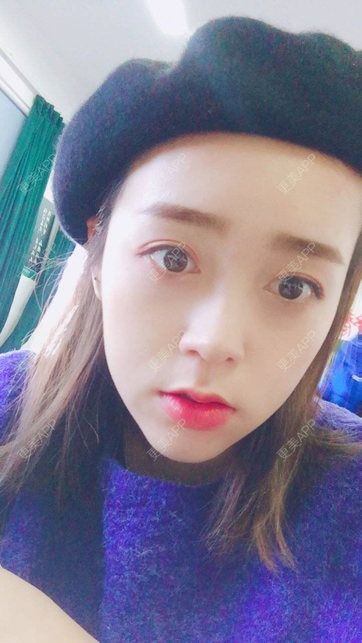 更美 - 更美用户m4XQ4UtYyh的菲欧曼经验 | 杭州 | 菲欧曼