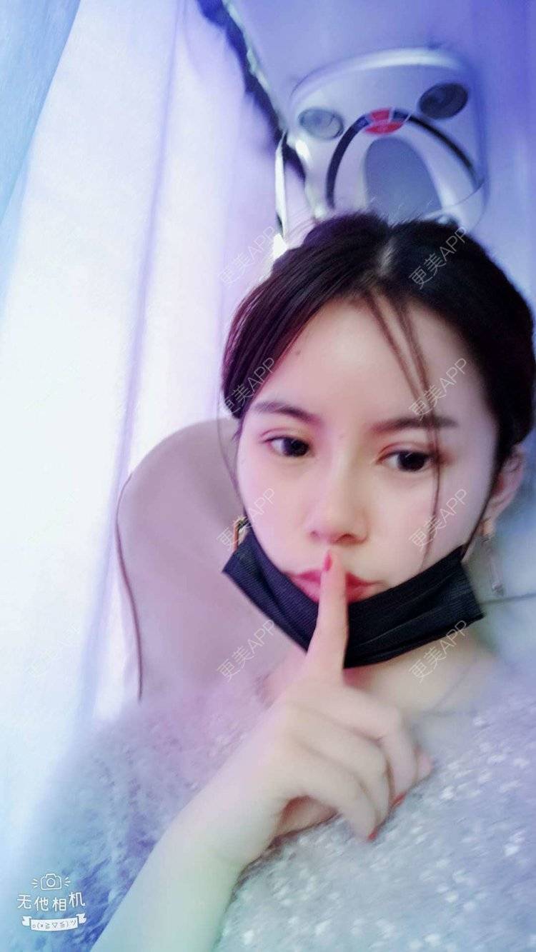 更美 - 更美用户tqiUzMAnQM的膨体隆鼻经验 | 膨体隆鼻 | 杭州