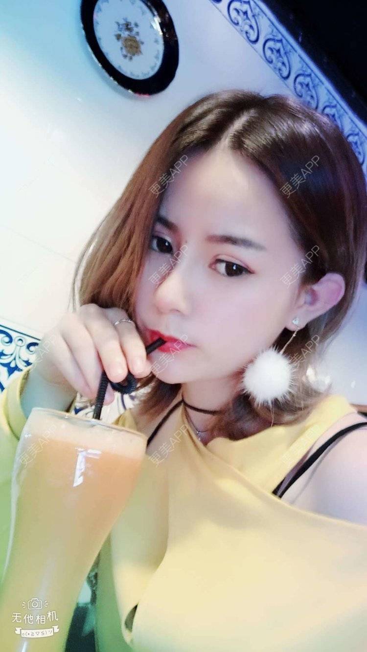 更美 - 更美用户tqiUzMAnQM的膨体隆鼻经验 | 膨体隆鼻 | 杭州
