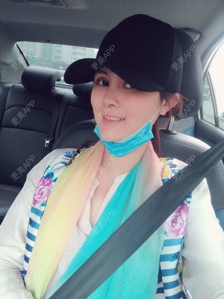 更美 - 更美用户M85cfJCnpD的膨体隆鼻经验 | 膨体隆鼻 | 杭州