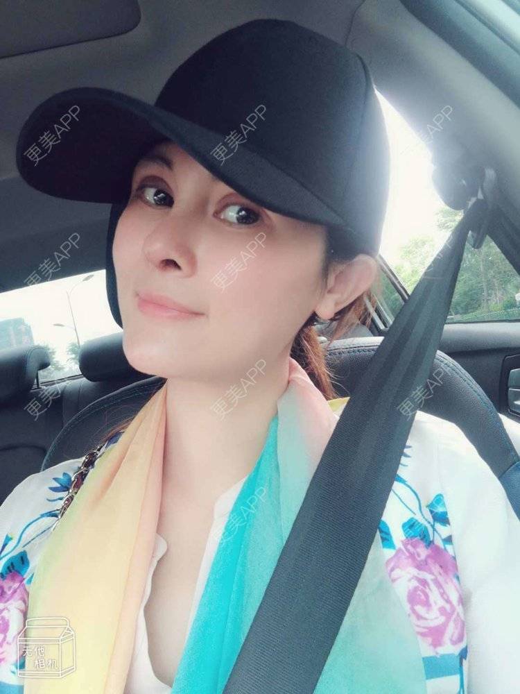 更美 - 更美用户M85cfJCnpD的膨体隆鼻经验 | 膨体隆鼻 | 杭州