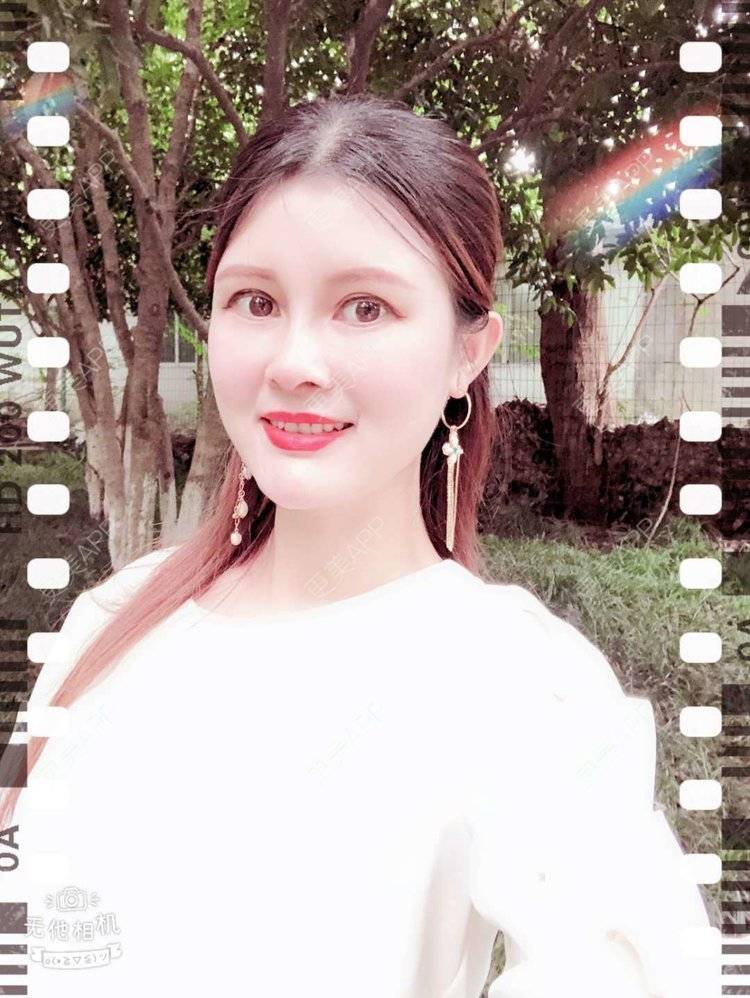 更美 - 更美用户M85cfJCnpD的膨体隆鼻经验 | 膨体隆鼻 | 杭州