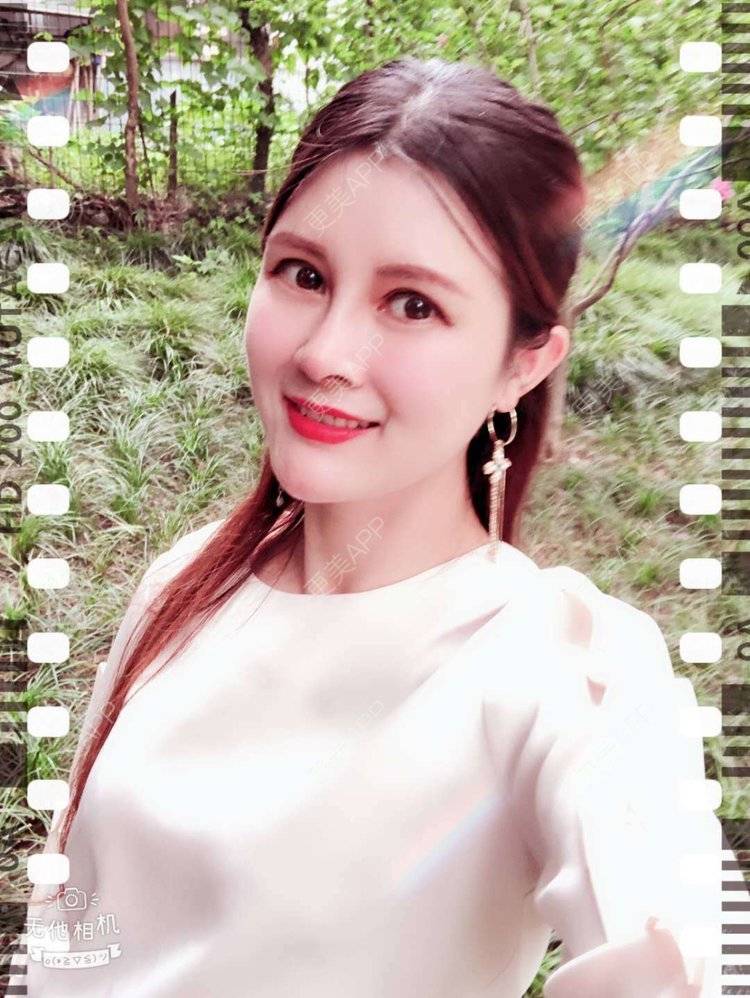 更美 - 更美用户M85cfJCnpD的膨体隆鼻经验 | 膨体隆鼻 | 杭州