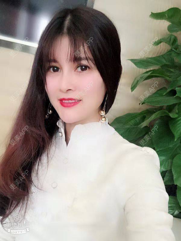 更美 - 更美用户M85cfJCnpD的膨体隆鼻经验 | 膨体隆鼻 | 杭州