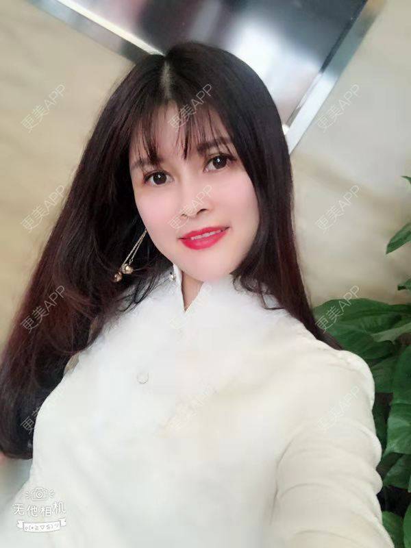 更美 - 更美用户M85cfJCnpD的膨体隆鼻经验 | 膨体隆鼻 | 杭州