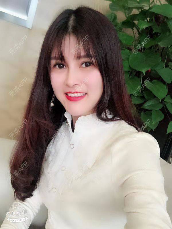 更美 - 更美用户M85cfJCnpD的膨体隆鼻经验 | 膨体隆鼻 | 杭州