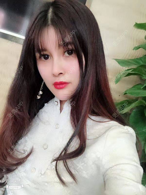 更美 - 更美用户M85cfJCnpD的膨体隆鼻经验 | 膨体隆鼻 | 杭州