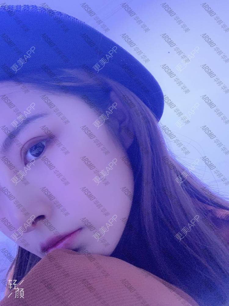 更美 - 北柠陌寒.的鼻部多项经验 | 视频日记 | 微晶瓷隆鼻 | 肋软骨隆鼻 | 鼻部多项 | 隆鼻 | 膨体隆鼻 | 长沙