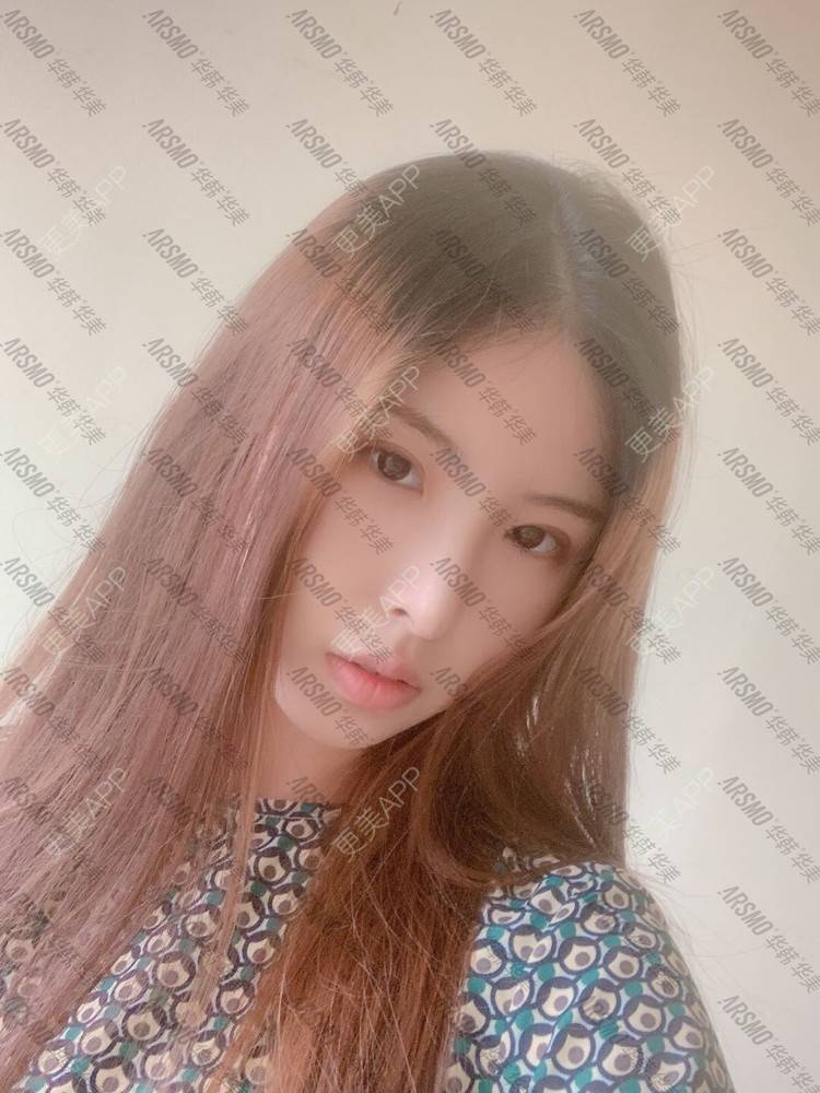 更美 - 北柠陌寒.的鼻部多项经验 | 微晶瓷隆鼻 | 肋软骨隆鼻 | 鼻部多项 | 隆鼻 | 膨体隆鼻 | 视频日记 | 长沙