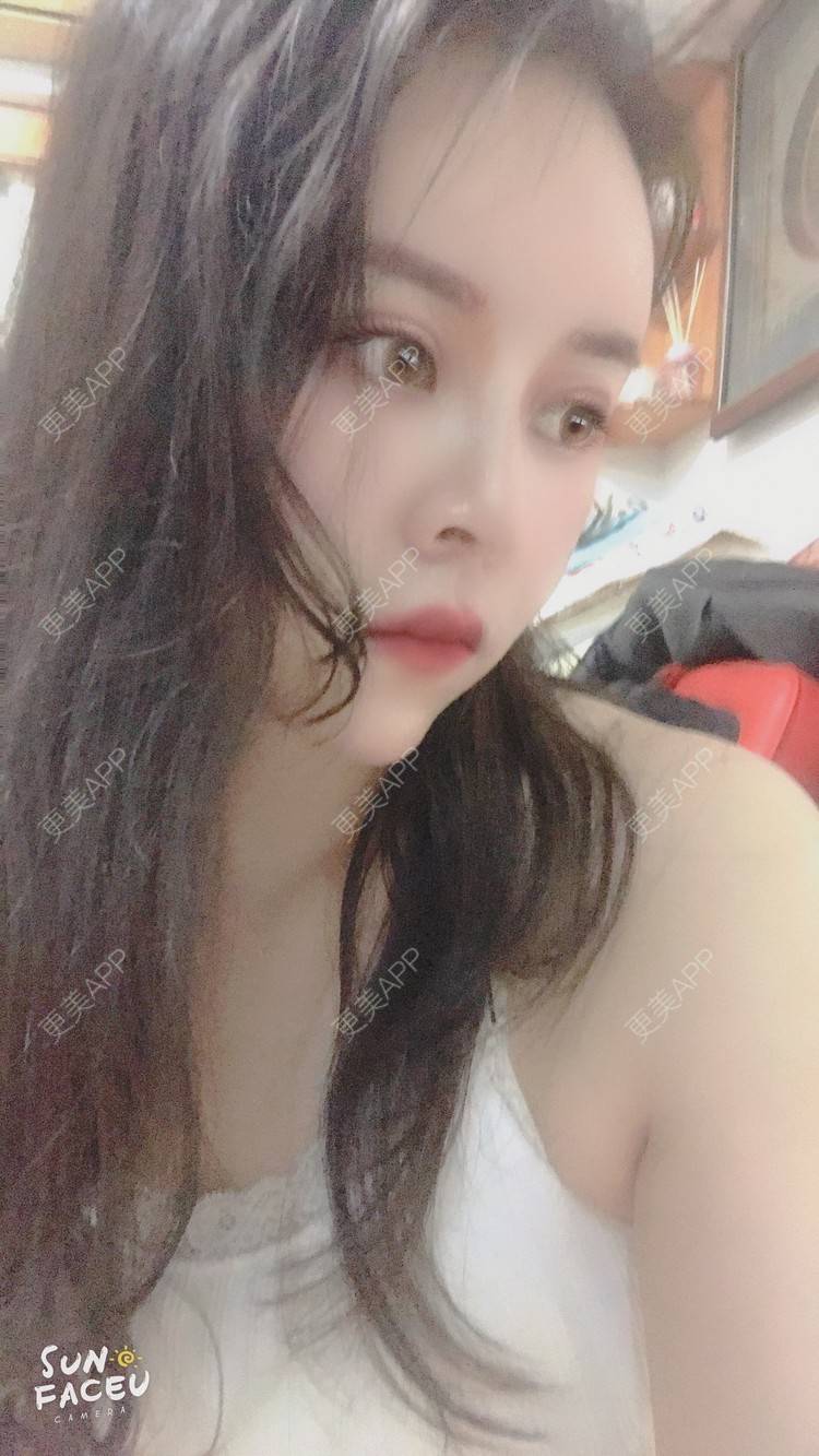 更美 - 更美用户iuB00h31N3的鼻部多项经验 | 鼻部多项 | 肋软骨隆鼻 | 广州