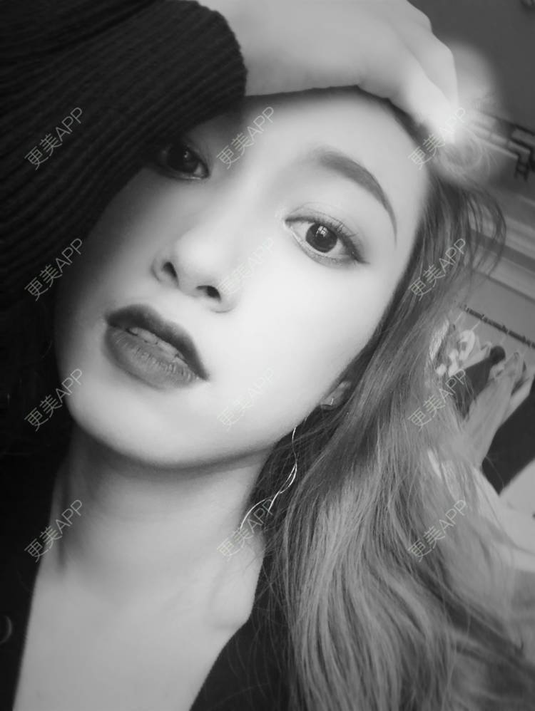 更美 - coollol的鼻部多项经验 | 鼻部多项 | 玻尿酸鼻部 | 肋软骨隆鼻 | 胶原蛋白隆鼻 | 埋线隆鼻 | 自体肋软骨垫鼻基底 | 成都