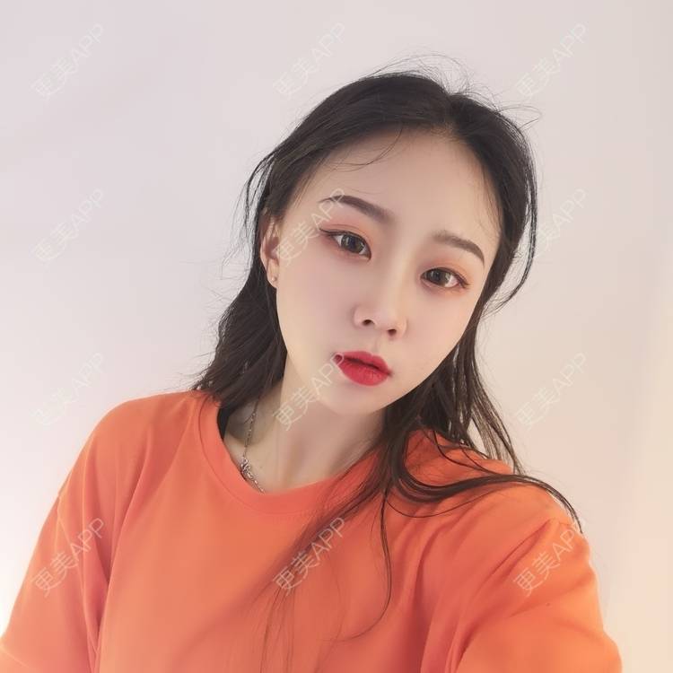 更美 - 更美用户vFETzv4uga的自体脂肪全面部填充经验 | 广州 | 自体脂肪全面部填充