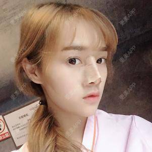 更美 - 换个新发型的鼻部多项经验 | 合肥 | 鼻部多项