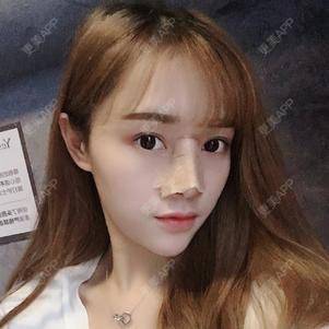 更美 - 换个新发型的鼻部多项经验 | 合肥 | 鼻部多项