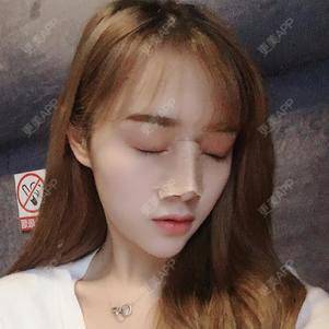 更美 - 换个新发型的鼻部多项经验 | 合肥 | 鼻部多项