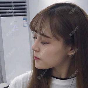 更美 - 换个新发型的鼻部多项经验 | 合肥 | 鼻部多项