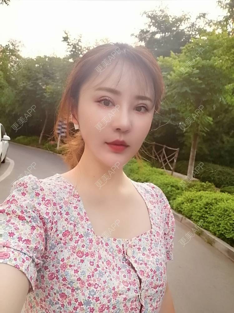 更美 - 静静子子的鼻部多项经验 | 鼻部多项 | 首尔