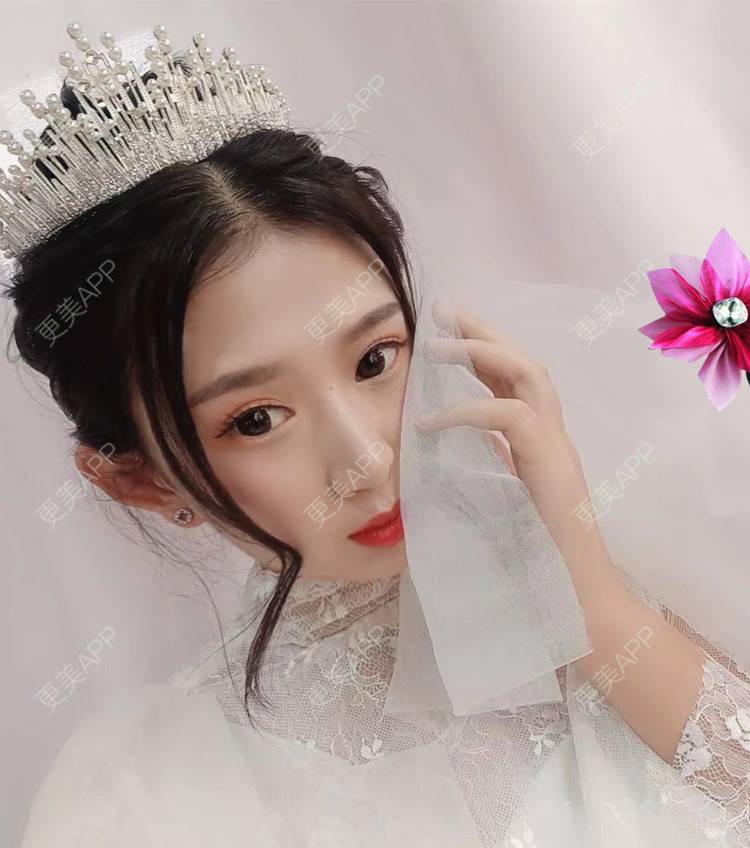 更美 - 更美用户GsPSepSvKO的双眼皮修复经验 | 广州 | 视频日记 | 双眼皮修复