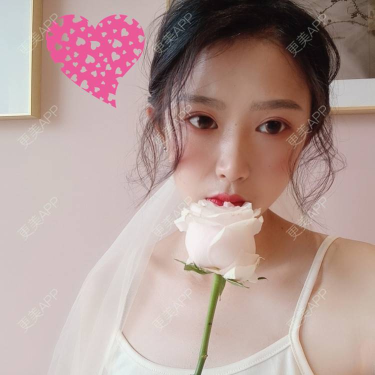 更美 - 更美用户GsPSepSvKO的双眼皮修复经验 | 广州 | 视频日记 | 双眼皮修复
