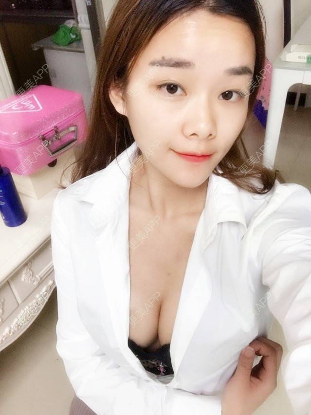 更美 - 更美用户nmgYekHkC0的假体隆胸经验 | 假体隆胸 | 胸部下垂矫正 | 美胸套餐 | 重庆