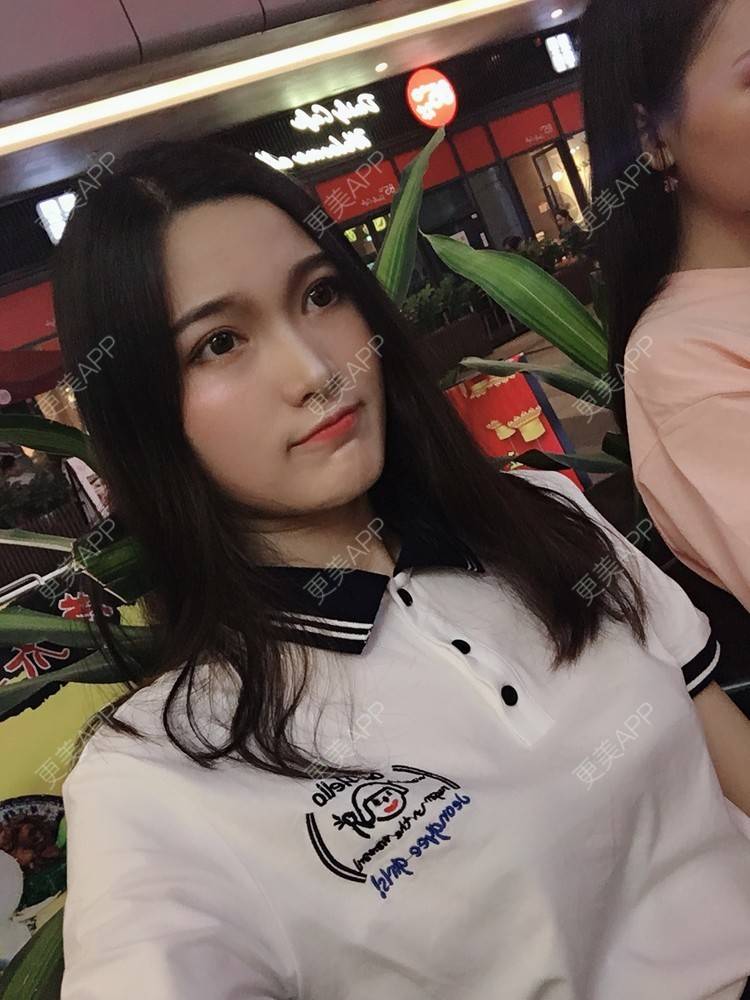 更美 - 我是小雨衣的眼部多项经验 | 开外眼角 | 视频日记 | 眼部多项 | 全切双眼皮 | 广州