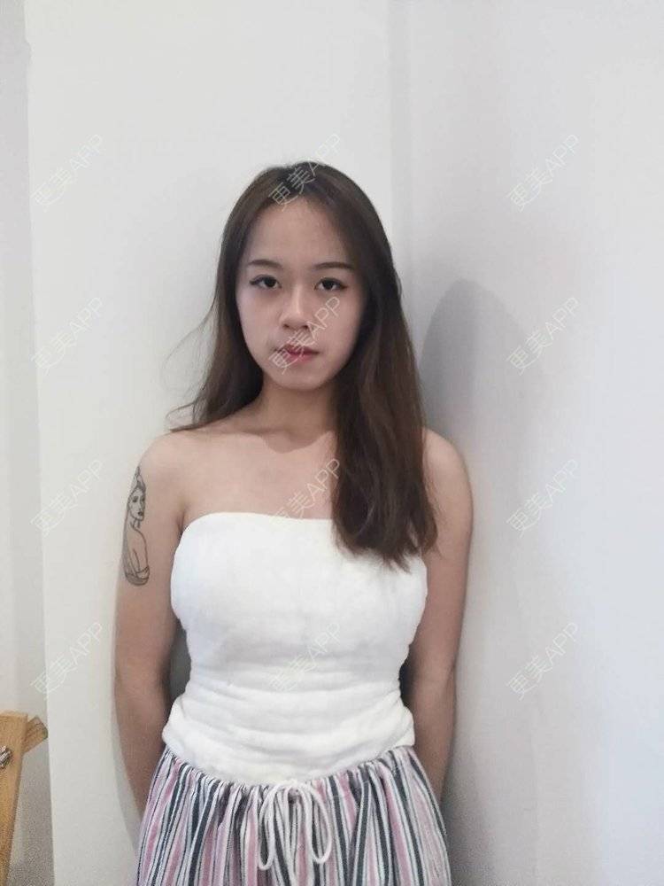 韶当晕emh的假体隆胸日记