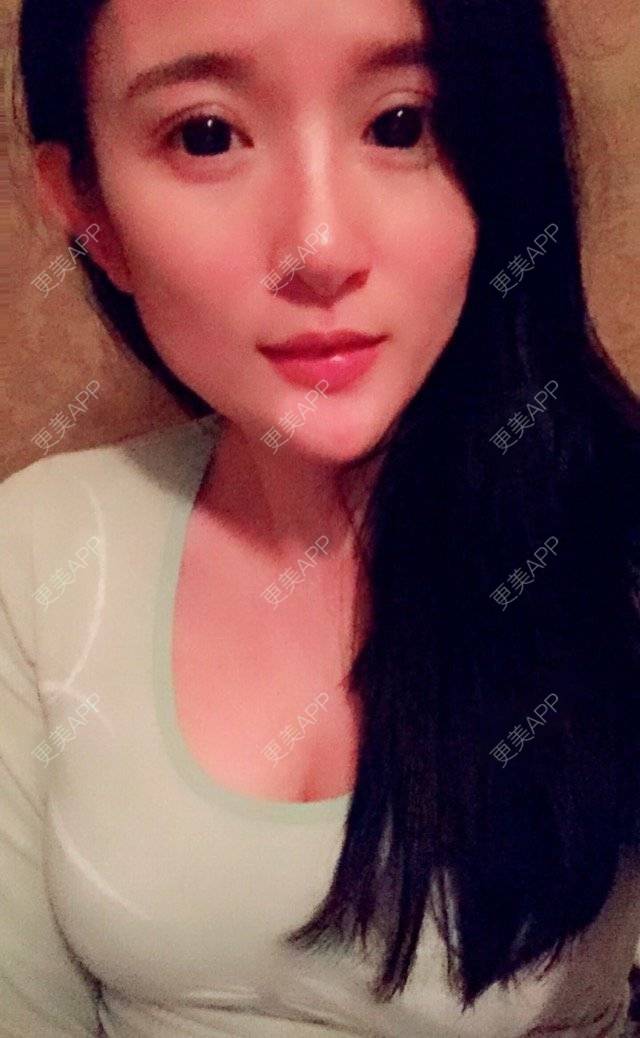 更美 - 更美用户bOtTiTFNHY的假体隆胸经验 | 假体隆胸 | 胸部下垂矫正 | 美胸套餐 | 重庆