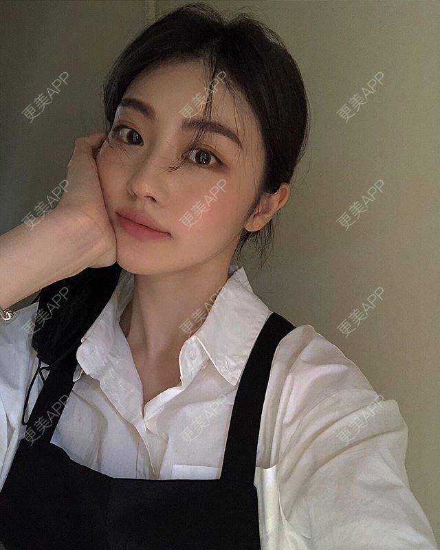 更美 - 更美用户unDCfzNjLB的唇综合经验 | 唇综合 | 南京