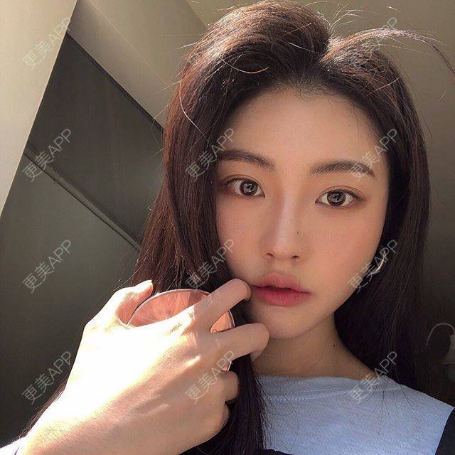 更美 - 更美用户unDCfzNjLB的唇综合经验 | 唇综合 | 南京