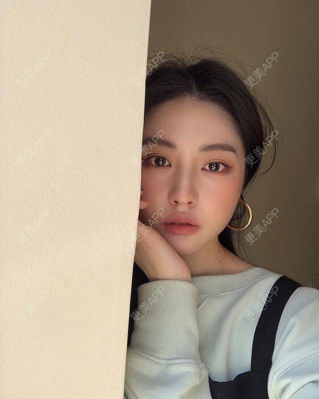 更美 - 更美用户unDCfzNjLB的唇综合经验 | 唇综合 | 南京