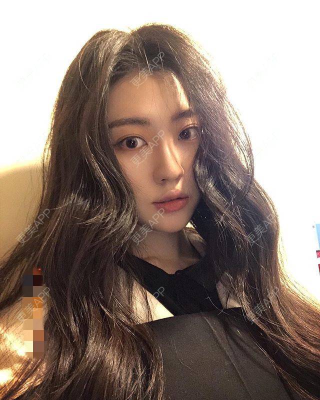更美 - 更美用户unDCfzNjLB的唇综合经验 | 唇综合 | 南京