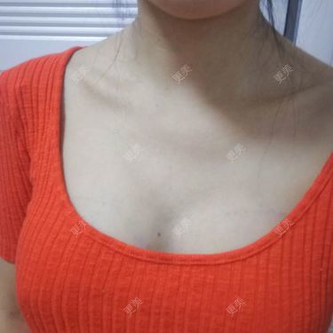 水里的一条鱼