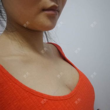 水里的一条鱼