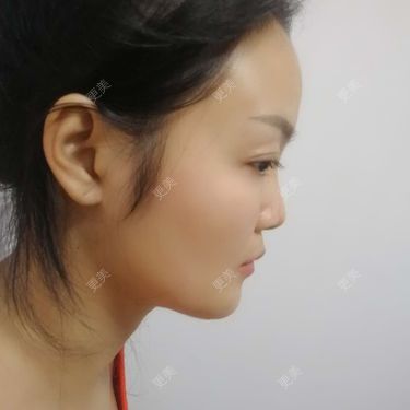 水里的一条鱼