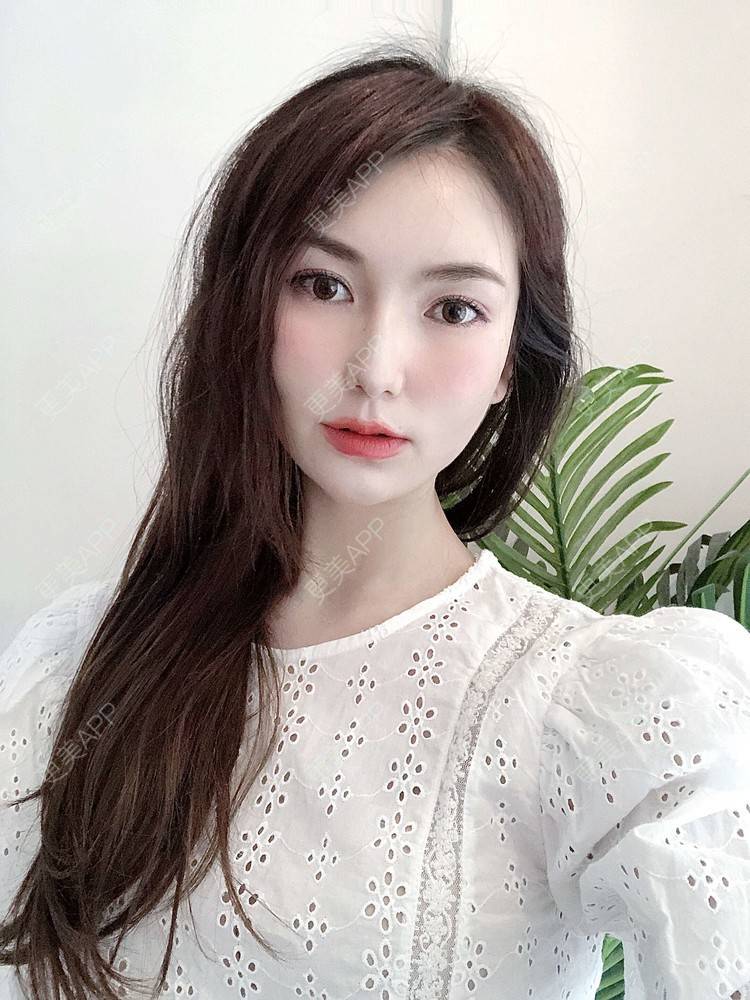 更美 - 更美用户GLhBqITBzy的热玛吉经验 | 成都 | 热玛吉