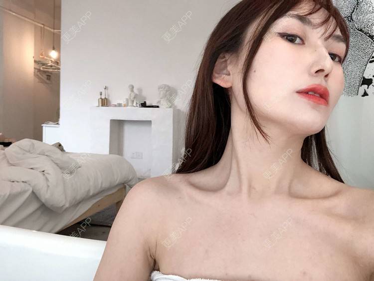 更美 - 更美用户GLhBqITBzy的热玛吉经验 | 成都 | 热玛吉