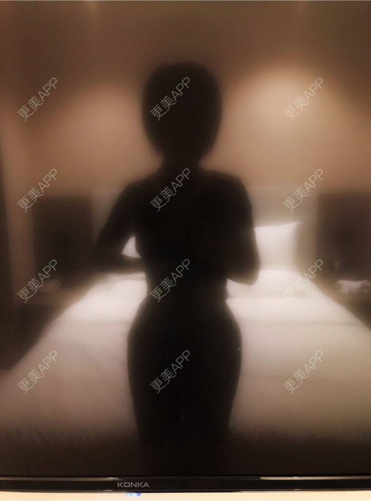 更美 - silent派的自体脂肪丰臀经验 | 自体脂肪丰臀 | 武汉