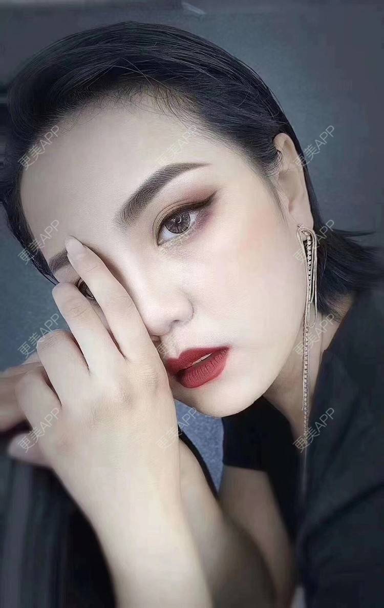 更美 - 更美用户zDiJ41DX6P的玻尿酸鼻部经验 | 玻尿酸鼻部 | 玻尿酸下巴 | 上海