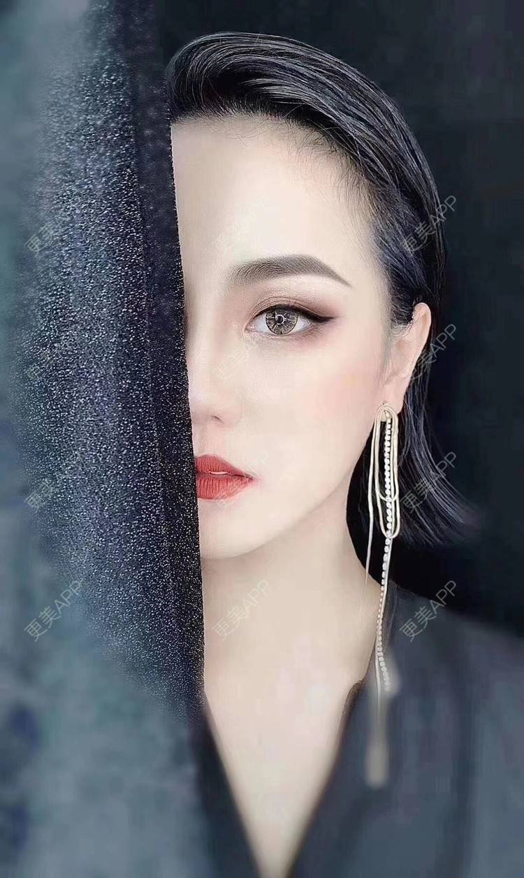 更美 - 更美用户zDiJ41DX6P的玻尿酸鼻部经验 | 玻尿酸鼻部 | 玻尿酸下巴 | 上海