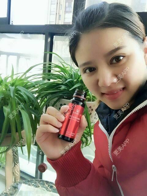 更美 - 阿小宝的全切双眼皮经验 | 全切双眼皮 | 定点双眼皮 | 开内眼角 | 开外眼角 | 成都