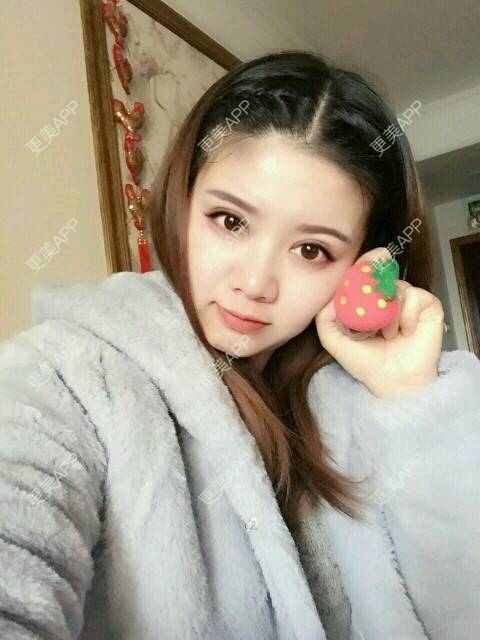 更美 - 阿小宝的全切双眼皮经验 | 全切双眼皮 | 定点双眼皮 | 开内眼角 | 开外眼角 | 成都