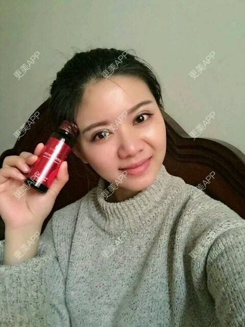 更美 - 阿小宝的全切双眼皮经验 | 全切双眼皮 | 定点双眼皮 | 开内眼角 | 开外眼角 | 成都